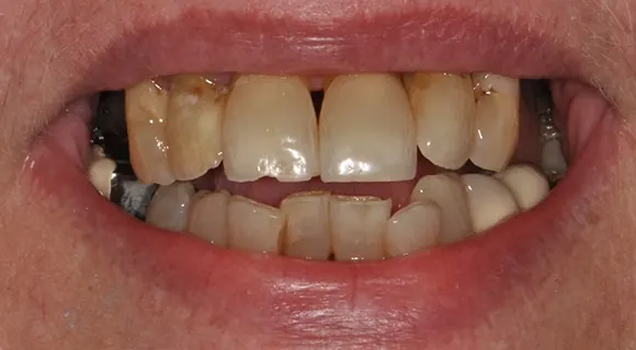 Case 3, before: yellowed.